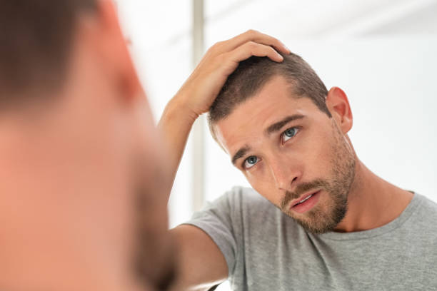 hair loss hair loss